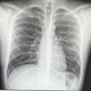 Meet your Posher, Begzod